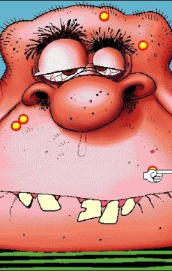 Acne Attack