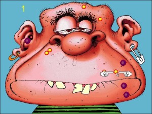 Acne Attack