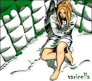 Varicella